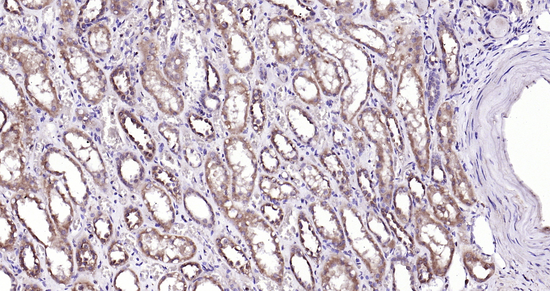 Paraformaldehyde-fixed, paraffin embedded Human kidney; Antigen retrieval by boiling in sodium citrate buffer (pH6.0) for 15min; Block endogenous peroxidase by 3% hydrogen peroxide for 20 minutes; Blocking buffer (normal goat serum) at 37°C for 30min; Antibody incubation with Adenylosuccinate Lyase Polyclonal Antibody, Unconjugated (bs-6352R) at 1:200 overnight at 4°C, DAB staining.