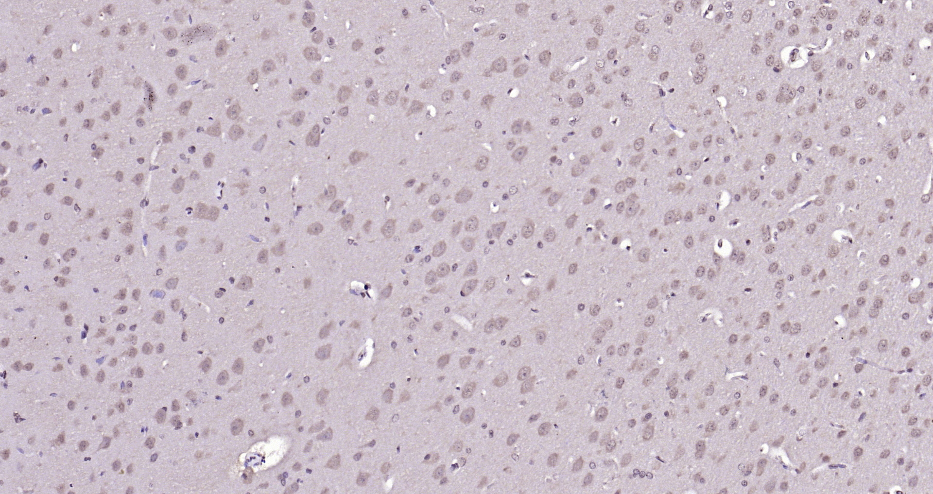 Paraformaldehyde-fixed, paraffin embedded Mouse brain; Antigen retrieval by boiling in sodium citrate buffer (pH6.0) for 15min; Block endogenous peroxidase by 3% hydrogen peroxide for 20 minutes; Blocking buffer (normal goat serum) at 37°C for 30min; Antibody incubation with ADRM1 Polyclonal Antibody, Unconjugated (bs-13357R) at 1:200 overnight at 4°C, DAB staining.