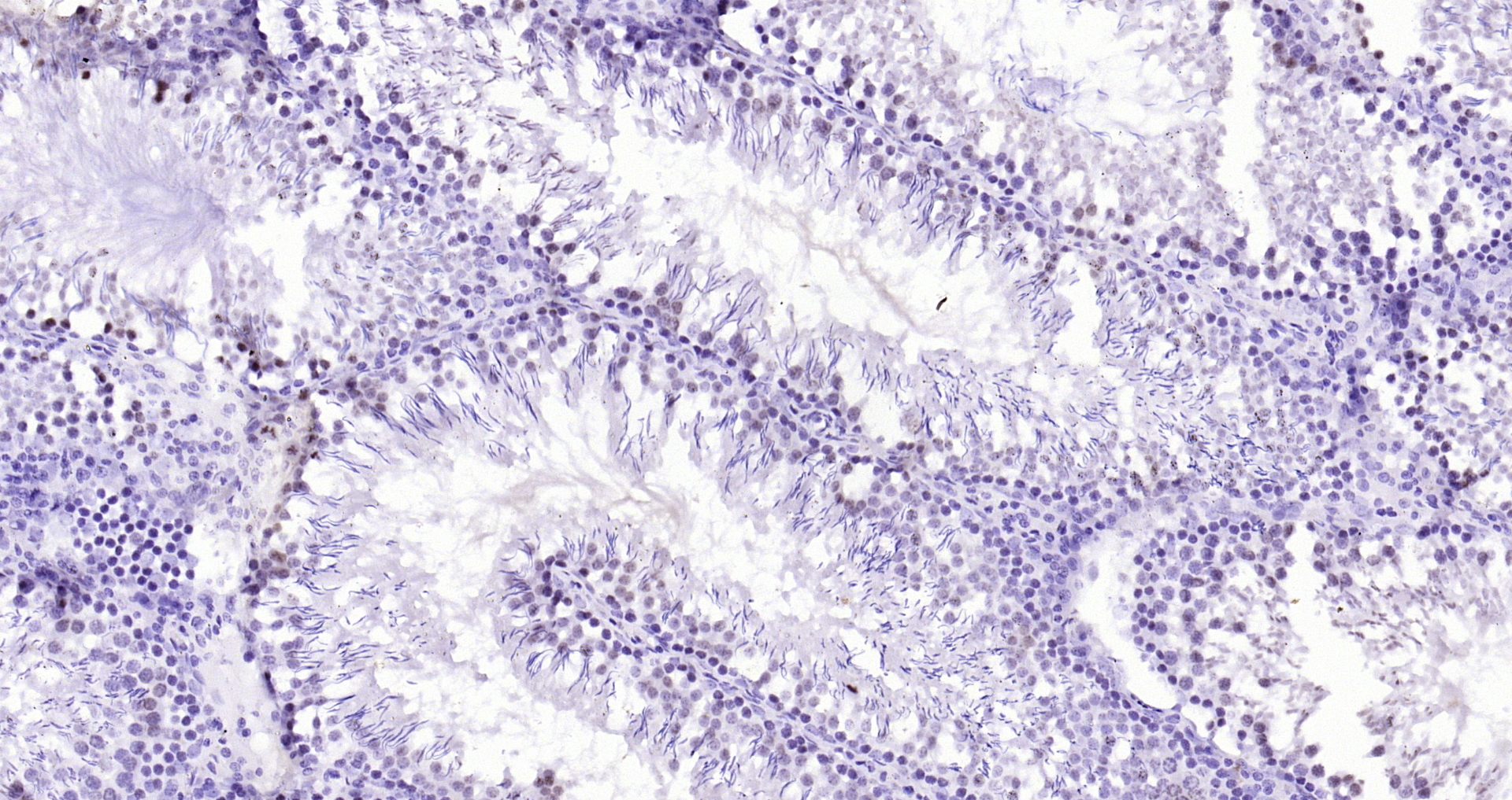 Paraformaldehyde-fixed, paraffin embedded Rat testis; Antigen retrieval by boiling in sodium citrate buffer (pH6.0) for 15min; Block endogenous peroxidase by 3% hydrogen peroxide for 20 minutes; Blocking buffer (normal goat serum) at 37°C for 30min; Antibody incubation with ADRM1 Polyclonal Antibody, Unconjugated (bs-13357R) at 1:200 overnight at 4°C, DAB staining.