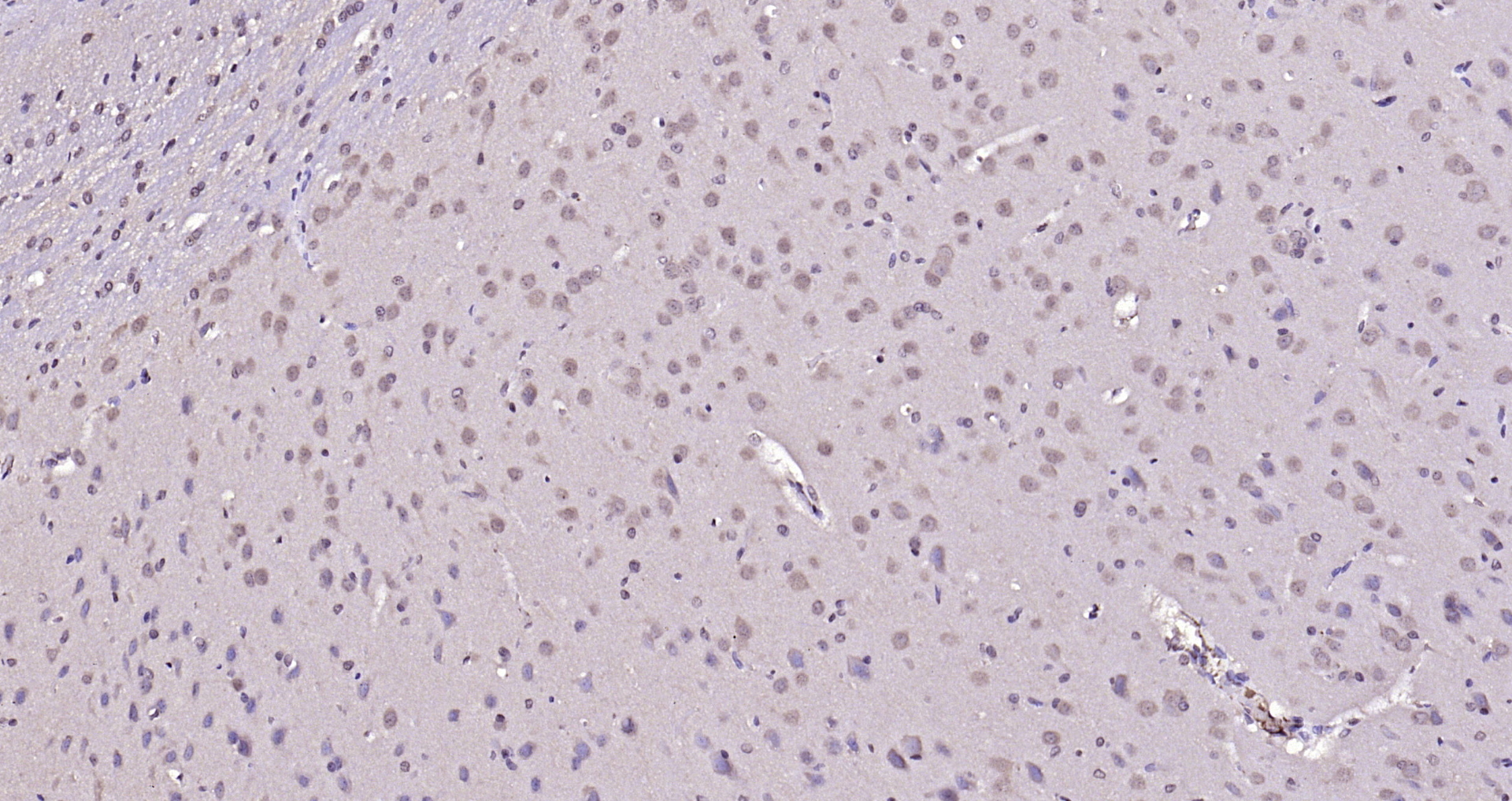 Paraformaldehyde-fixed, paraffin embedded Rat brain; Antigen retrieval by boiling in sodium citrate buffer (pH6.0) for 15min; Block endogenous peroxidase by 3% hydrogen peroxide for 20 minutes; Blocking buffer (normal goat serum) at 37°C for 30min; Antibody incubation with ADRM1 Polyclonal Antibody, Unconjugated (bs-13357R) at 1:200 overnight at 4°C, DAB staining.