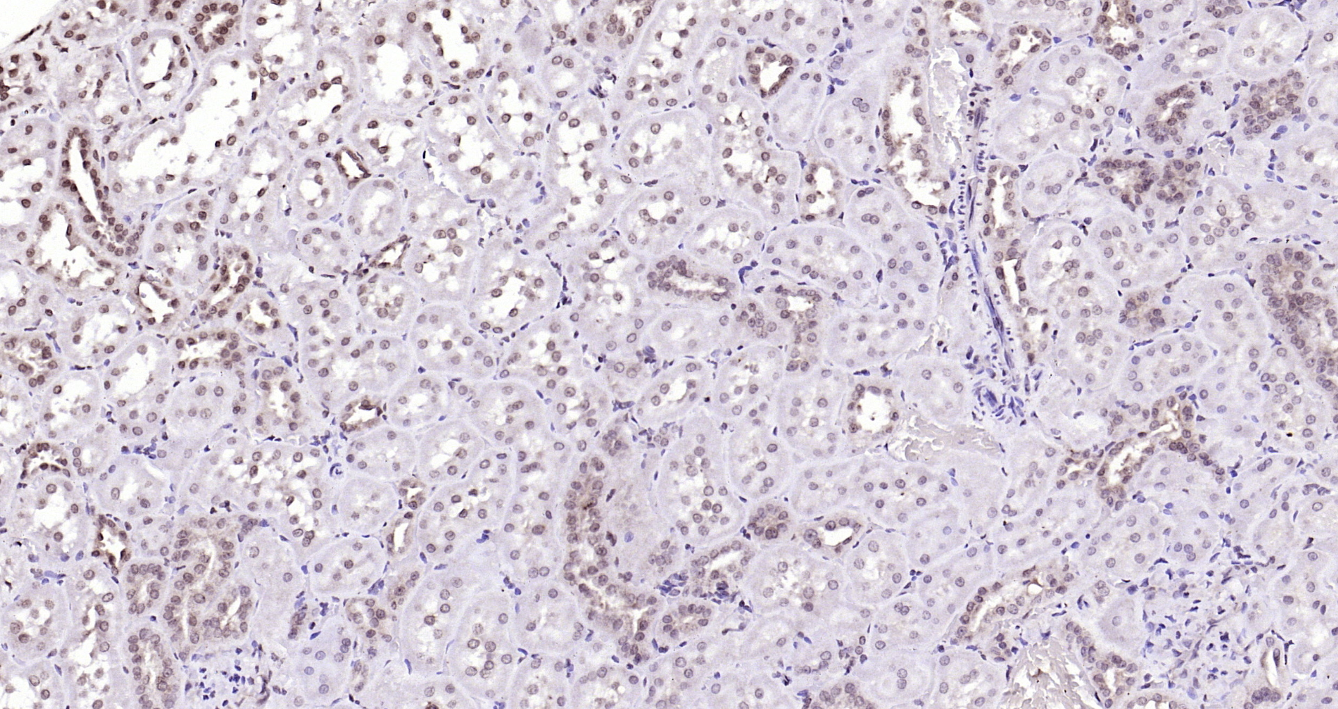 Paraformaldehyde-fixed, paraffin embedded Rat kidney; Antigen retrieval by boiling in sodium citrate buffer (pH6.0) for 15min; Block endogenous peroxidase by 3% hydrogen peroxide for 20 minutes; Blocking buffer (normal goat serum) at 37°C for 30min; Antibody incubation with ADRM1 Polyclonal Antibody, Unconjugated (bs-13357R) at 1:200 overnight at 4°C, DAB staining.