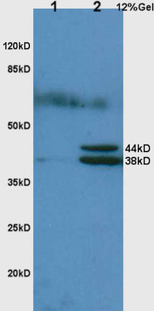 L1 rat lung lysates L2 rat liver lysates probed with Anti Hpt/Haptoglobin Polyclonal Antibody, Unconjugated (bs-1808R) at 1:200 in 4˚C. Followed by conjugation to secondary antibody (bs-0295G-HRP) at 1:3000 90min in 37˚C. Predicted band 44kD. Observed band size: 38kD,44kD