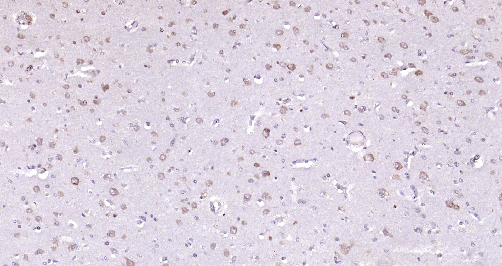 Paraformaldehyde-fixed, paraffin embedded Human brain; Antigen retrieval by boiling in sodium citrate buffer (pH6.0) for 15min; Block endogenous peroxidase by 3% hydrogen peroxide for 20 minutes; Blocking buffer (normal goat serum) at 37°C for 30min; Antibody incubation with ADRM1 Polyclonal Antibody, Unconjugated (bs-13357R) at 1:200 overnight at 4°C, DAB staining.
