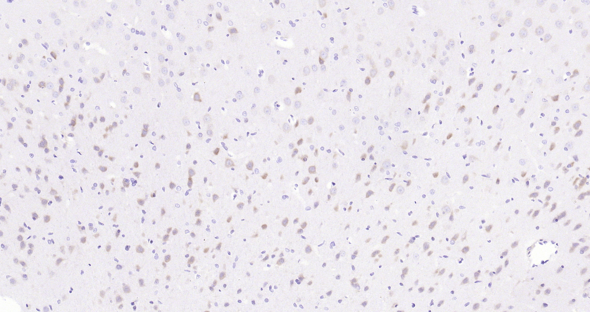 Paraformaldehyde-fixed, paraffin embedded Mouse brain; Antigen retrieval by boiling in sodium citrate buffer (pH6.0) for 15min; Block endogenous peroxidase by 3% hydrogen peroxide for 20 minutes; Blocking buffer (normal goat serum) at 37°C for 30min; Antibody incubation with eIF4E(S209) (2B1) Monoclonal Antibody, Unconjugated (bsm-52152R) at 1:200 overnight at 4°C, DAB staining.
