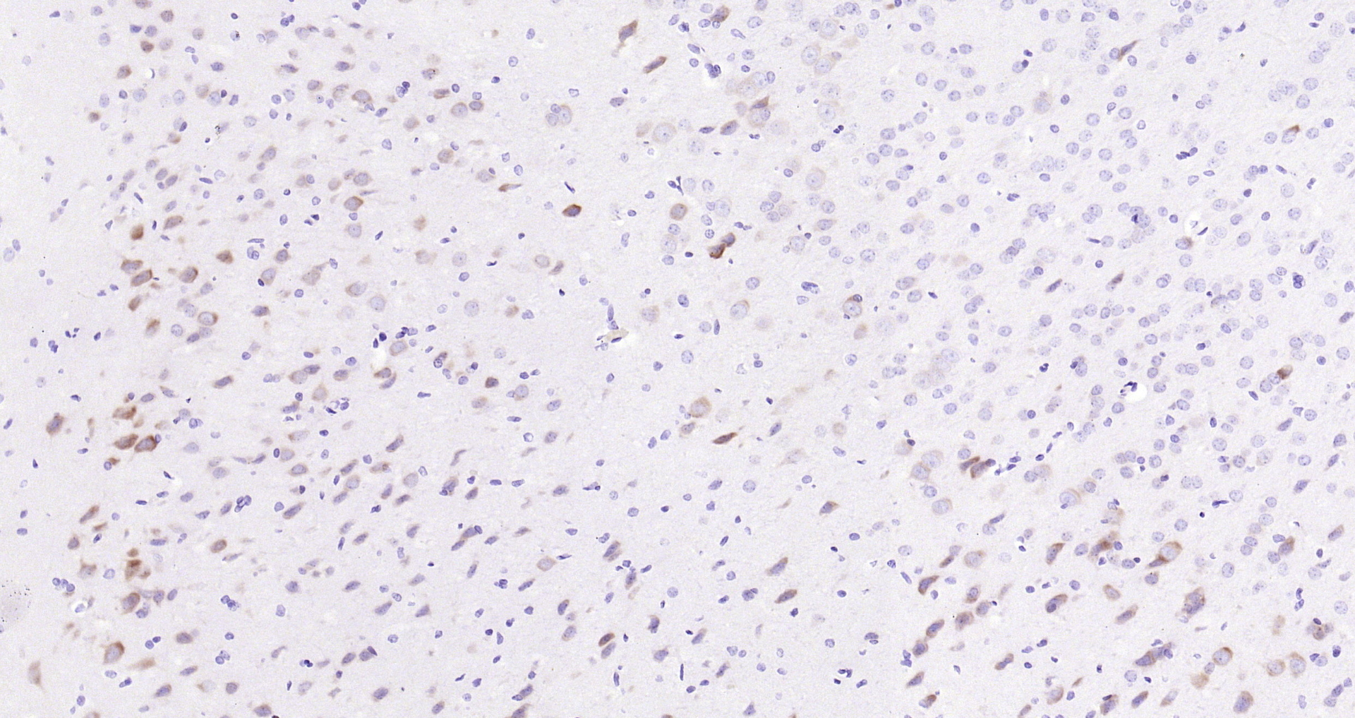 Paraformaldehyde-fixed, paraffin embedded Rat brain; Antigen retrieval by boiling in sodium citrate buffer (pH6.0) for 15min; Block endogenous peroxidase by 3% hydrogen peroxide for 20 minutes; Blocking buffer (normal goat serum) at 37°C for 30min; Antibody incubation with eIF4E(S209) (2B1) Monoclonal Antibody, Unconjugated (bsm-52152R) at 1:200 overnight at 4°C, DAB staining.