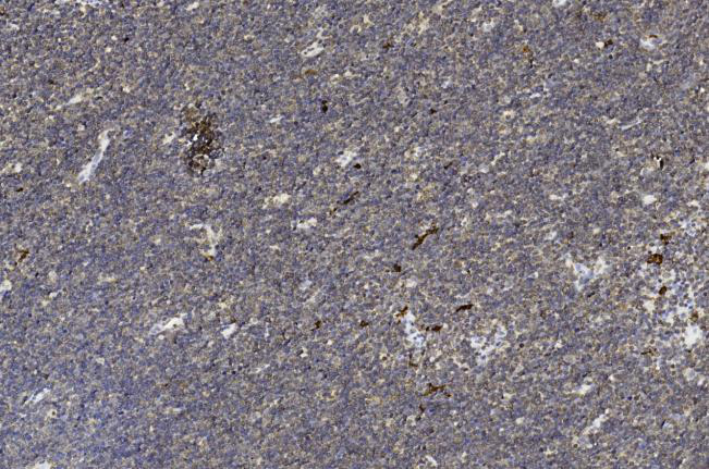 Paraformaldehyde-fixed, paraffin embedded Human thymus; Antigen retrieval by boiling in sodium citrate buffer (pH6.0) for 15min; Block endogenous peroxidase by 3% hydrogen peroxide for 20 minutes; Blocking buffer (normal goat serum) at 37°C for 30min; Antibody incubation with H2AFX (8C5) Monoclonal Antibody, Unconjugated (bsm-51222M) at 1:50 overnight at 4°C, DAB staining.