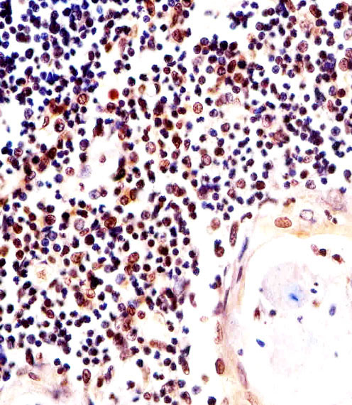 Paraformaldehyde-fixed, paraffin embedded Human thymus; Antigen retrieval by boiling in sodium citrate buffer (pH6.0) for 15min; Block endogenous peroxidase by 3% hydrogen peroxide for 20 minutes; Blocking buffer (normal goat serum) at 37°C for 30min; Antibody incubation with H2AFX (8C5) Monoclonal Antibody, Unconjugated (bsm-51222M) at 1:25 overnight at 4°C, DAB staining.
