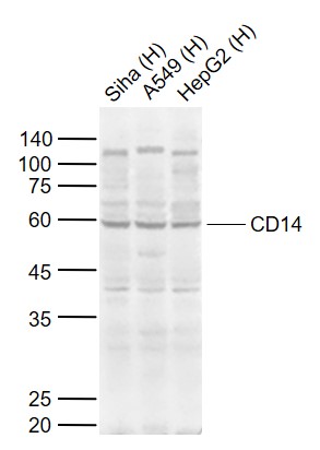 Lane 1: Human Siha cell lysates; Lane 2: Human A549 cell lysates; Lane 3: Human HepG2 cell lysates probed with CD14 Polyclonal Antibody, Unconjugated (bs-1192R) at 1:1000 dilution and 4\u00b0C overnight incubation. Followed by conjugated secondary antibody incubation at 1:20000 for 60 min at 37˚C.