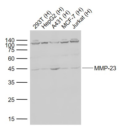 Lane 1: Human 293T cell lysates; Lane 2: Human HepG2 cell lysates; Lane 3: Human A431 cell lysates; Lane 4: Human MCF-7 cell lysates ; Lane 5: Human Jurkat cell lysates probed with MMP-23 Polyclonal Antibody, Unconjugated (bs-5875R) at 1:1000 dilution and 4°C overnight incubation. Followed by conjugated secondary antibody incubation at 1:20000 for 60 min at 37˚C.