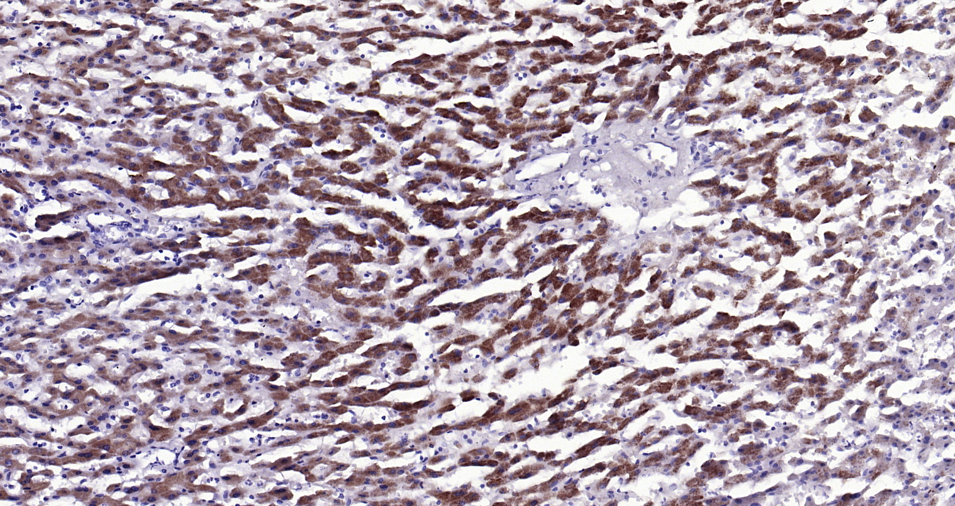 Paraformaldehyde-fixed, paraffin embedded Human liver; Antigen retrieval by boiling in sodium citrate buffer (pH6.0) for 15min; Block endogenous peroxidase by 3% hydrogen peroxide for 20 minutes; Blocking buffer (normal goat serum) at 37°C for 30min; Antibody incubation with GNMT Polyclonal Antibody, Unconjugated (bs-2396R) at 1:200 overnight at 4°C, DAB staining.