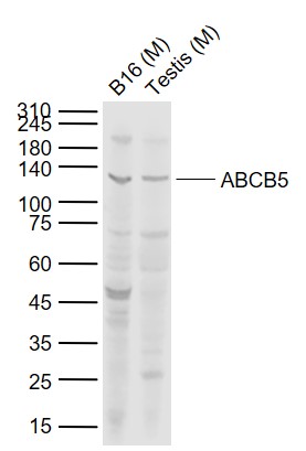 Lane 1: Mouse B16 cell lysates; Lane 2: Mouse Testis tissue lysates probed with ABCB5 Polyclonal Antibody, Unconjugated (bs-1604R) at 1:1000 dilution and 4°C overnight incubation. Followed by conjugated secondary antibody incubation at 1:20000 for 60 min at 37˚C.