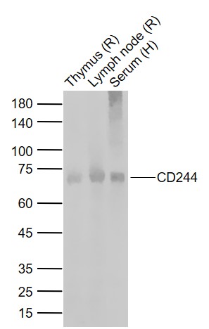 Lane 1: Mouse Thymus tissue lysates; Lane 2: Rat Lymph node tissue lysates; Lane 3: Human Serum probed with CD244 Polyclonal Antibody, Unconjugated (bs-2470R) at 1:1000 dilution and 4\u00b0C overnight incubation. Followed by conjugated secondary antibody incubation at 1:20000 for 60 min at 37˚C.
