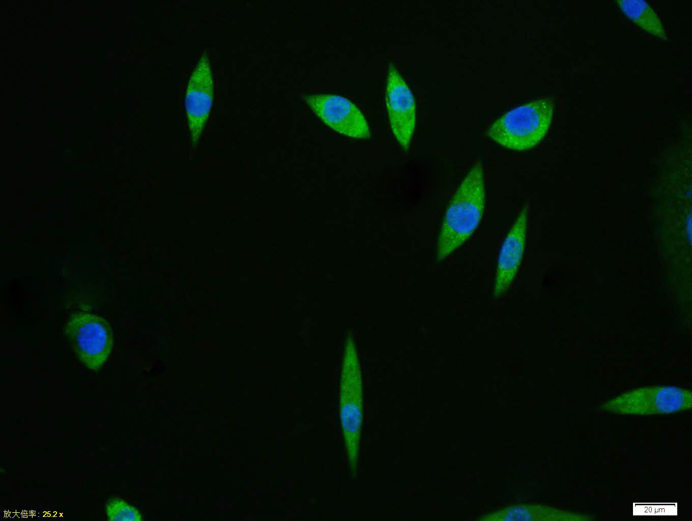 SH-SY5Y cell; 4% Paraformaldehyde-fixed; Triton X-100 at room temperature for 20 min; Blocking buffer (normal goat serum, C-0005) at 37°C for 20 min; Antibody incubation with (alpha-Synuclein) polyclonal Antibody, Unconjugated (bs-0009R) 1:100, 90 minutes at 37°C; followed by a conjugated Goat Anti-Rabbit IgG antibody at 37°C for 90 minutes, DAPI (blue, C02-04002) was used to stain the cell nuclei.