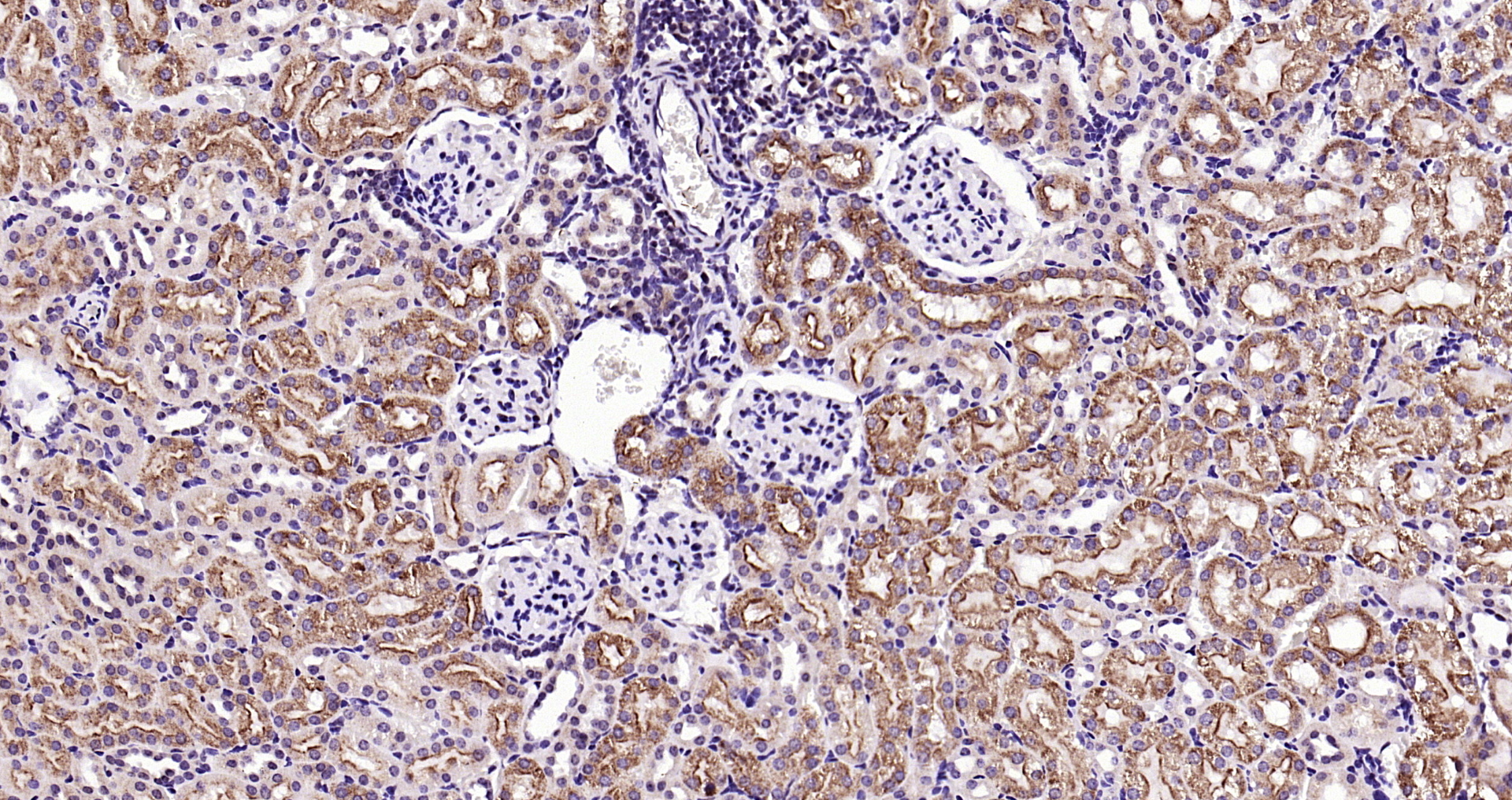 Paraformaldehyde-fixed, paraffin embedded Mouse kidney; Antigen retrieval by boiling in sodium citrate buffer (pH6.0) for 15min; Block endogenous peroxidase by 3% hydrogen peroxide for 20 minutes; Blocking buffer (normal goat serum) at 37°C for 30min; Antibody incubation with KLK1 Polyclonal Antibody, Unconjugated (bs-1963R) at 1:200 overnight at 4°C, DAB staining.