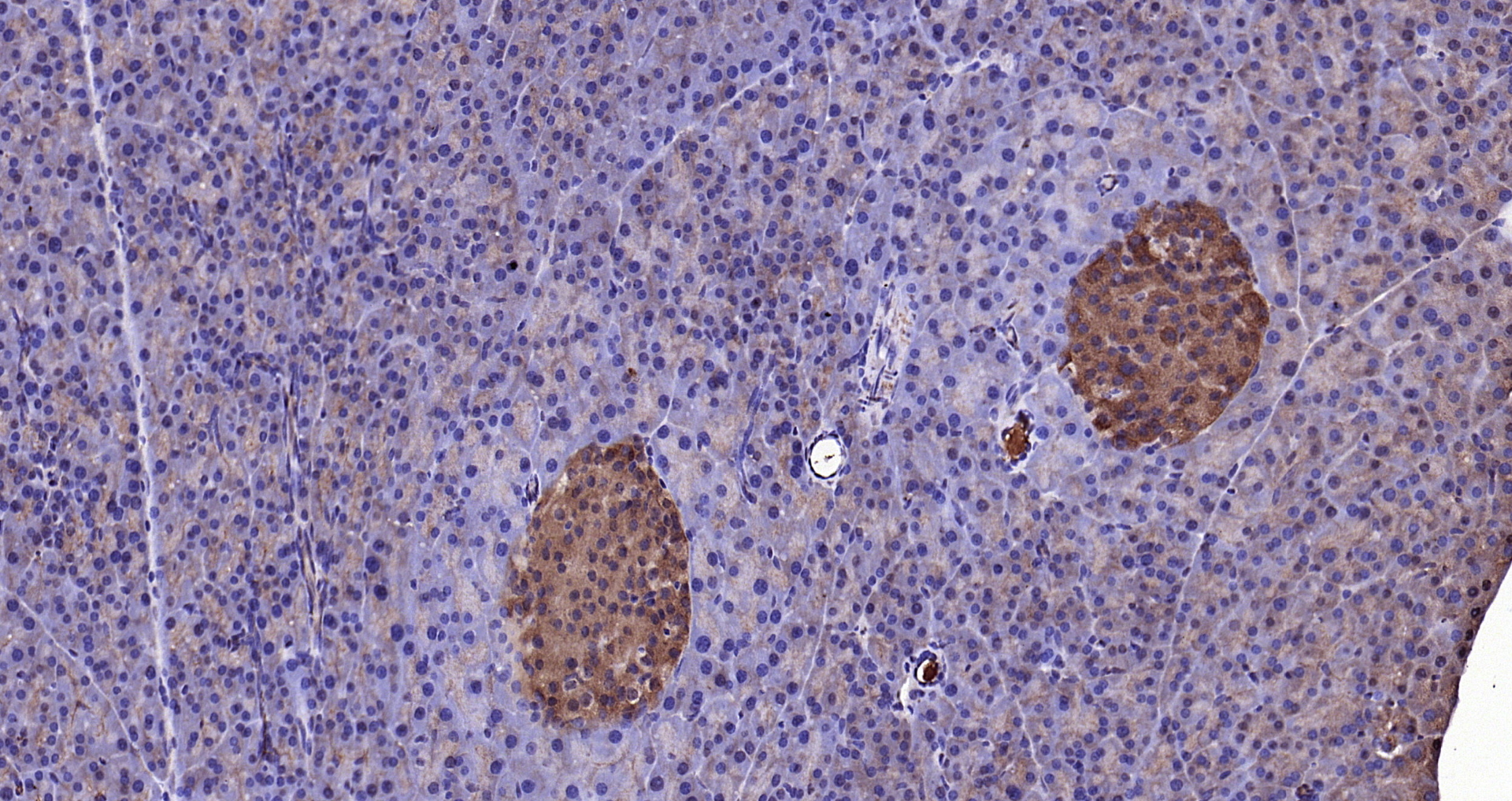 Paraformaldehyde-fixed, paraffin embedded Mouse pancreas; Antigen retrieval by boiling in sodium citrate buffer (pH6.0) for 15min; Block endogenous peroxidase by 3% hydrogen peroxide for 20 minutes; Blocking buffer (normal goat serum) at 37°C for 30min; Antibody incubation with KLK1 Polyclonal Antibody, Unconjugated (bs-1963R) at 1:200 overnight at 4°C, DAB staining.