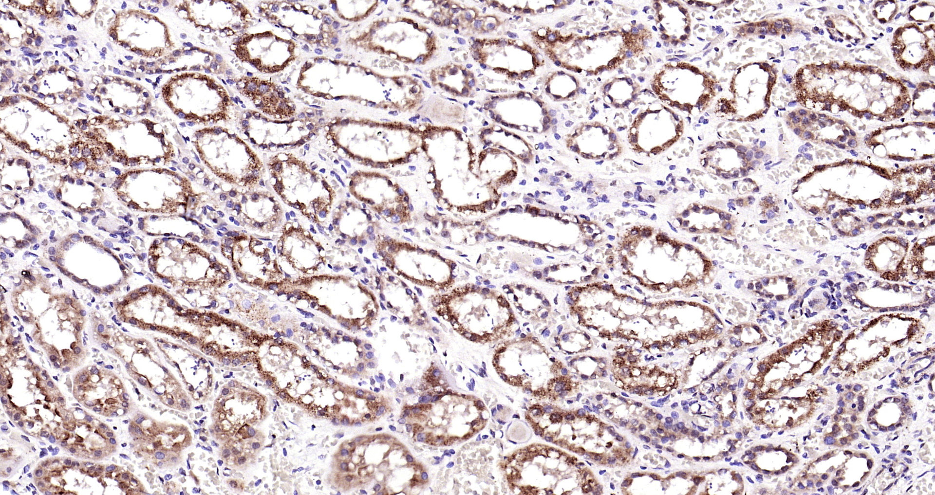 Paraformaldehyde-fixed, paraffin embedded Human kidney; Antigen retrieval by boiling in sodium citrate buffer (pH6.0) for 15min; Block endogenous peroxidase by 3% hydrogen peroxide for 20 minutes; Blocking buffer (normal goat serum) at 37°C for 30min; Antibody incubation with KLK1 Polyclonal Antibody, Unconjugated (bs-1963R) at 1:200 overnight at 4°C, DAB staining.