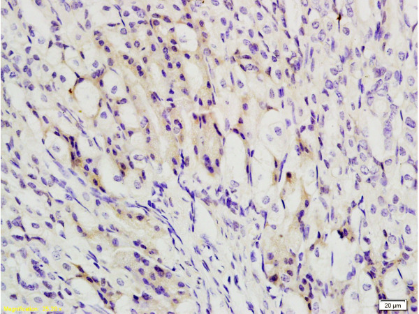 Formalin-fixed and paraffin embedded mouse stomach labeled with Anti-TBL1X Polyclonal Antibody, Unconjugated (bs-4219R)at 1:200 followed by conjugation to the secondary antibody and DAB staining