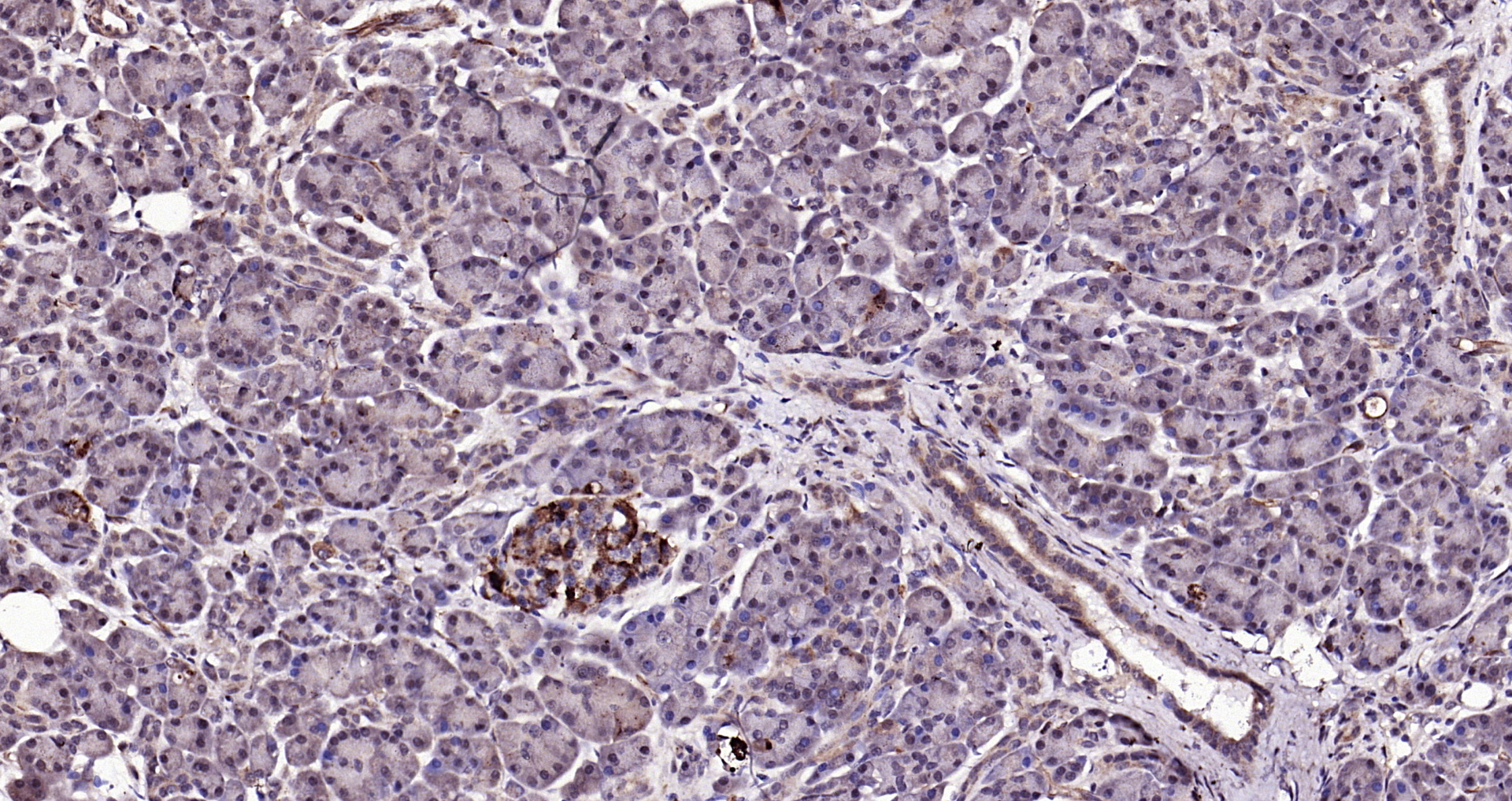Paraformaldehyde-fixed, paraffin embedded Human pancreatic cancer; Antigen retrieval by boiling in sodium citrate buffer (pH6.0) for 15min; Block endogenous peroxidase by 3% hydrogen peroxide for 20 minutes; Blocking buffer (normal goat serum) at 37°C for 30min; Antibody incubation with KLK1 Polyclonal Antibody, Unconjugated (bs-1963R) at 1:200 overnight at 4°C, DAB staining.