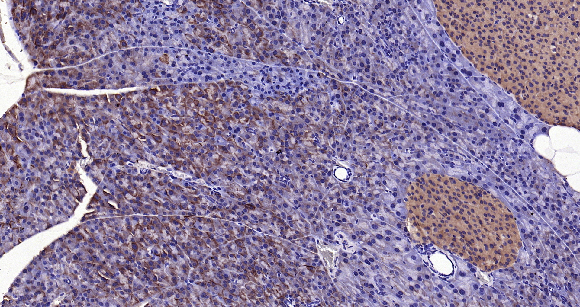 Paraformaldehyde-fixed, paraffin embedded Mouse pancreas; Antigen retrieval by boiling in sodium citrate buffer (pH6.0) for 15min; Block endogenous peroxidase by 3% hydrogen peroxide for 20 minutes; Blocking buffer (normal goat serum) at 37°C for 30min; Antibody incubation with SLC26A6 Polyclonal Antibody, Unconjugated (bs-20817R) at 1:200 overnight at 4°C, DAB staining.