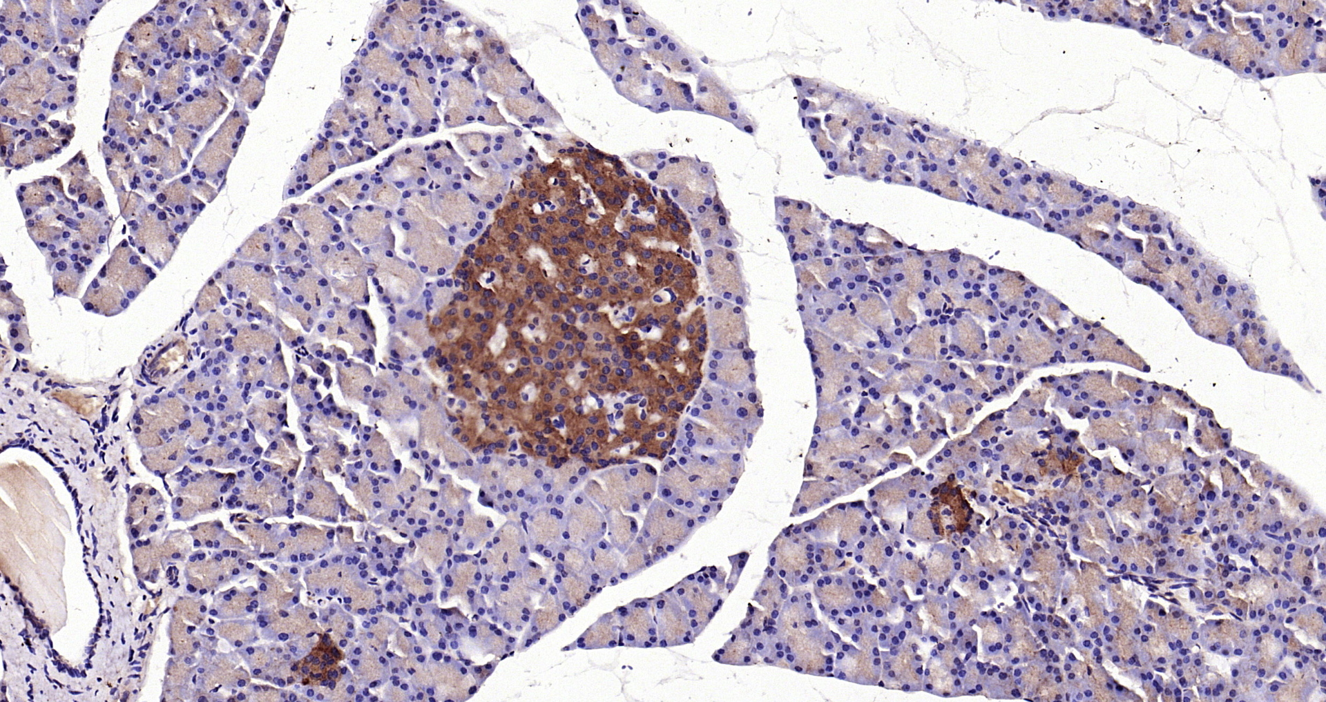 Paraformaldehyde-fixed, paraffin embedded Rat pancreas; Antigen retrieval by boiling in sodium citrate buffer (pH6.0) for 15min; Block endogenous peroxidase by 3% hydrogen peroxide for 20 minutes; Blocking buffer (normal goat serum) at 37°C for 30min; Antibody incubation with SLC26A6 Polyclonal Antibody, Unconjugated (bs-20817R) at 1:200 overnight at 4°C, DAB staining.
