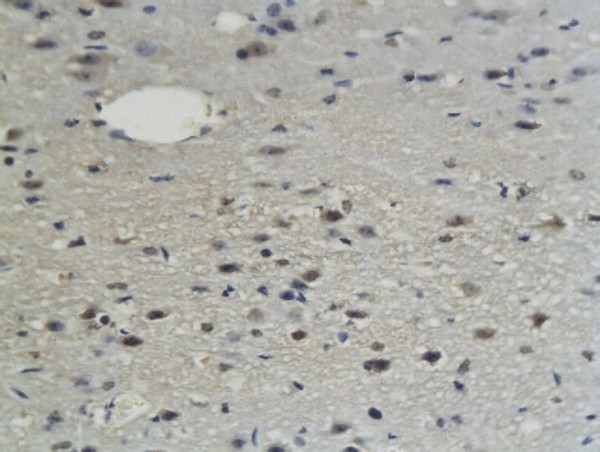 Formalin-fixed and paraffin embedded mouse brain labeled with Anti-Sphingomyelin Synthase 1 Polyclonal Antibody, Unconjugated (bs-4216R) followed by conjugation to the secondary antibody and DAB staining