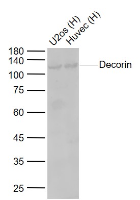 Lane 1: Human U2os cell lysates; Lane 2: Human Huvec cell lysates probed with Decorin Polyclonal Antibody, Unconjugated (bs-1695R) at 1:1000 dilution and 4\u00b0C overnight incubation. Followed by conjugated secondary antibody incubation at 1:20000 for 60 min at 37˚C.