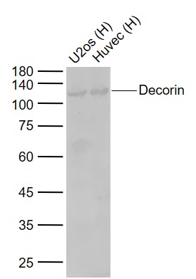 Lane 1: Human U2os cell lysates; Lane 2: Human Huvec cell lysates probed with Decorin Polyclonal Antibody, Unconjugated (bs-1695R) at 1:1000 dilution and 4°C overnight incubation. Followed by conjugated secondary antibody incubation at 1:20000 for 60 min at 37˚C.