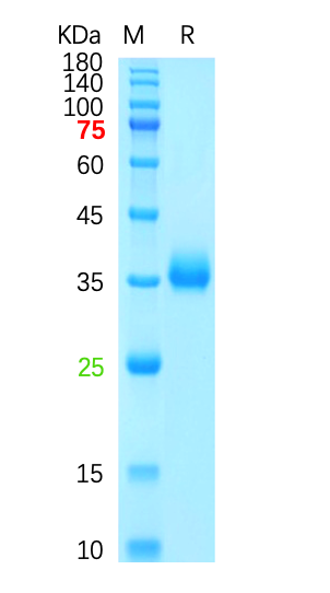 Recombinant SARS-CoV-2 Spike RBD (L452R,T478K) Protein – Bioss