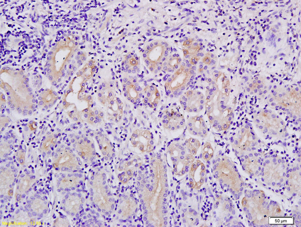 Formalin-fixed and paraffin embedded human stomach tissue labeled with Anti-MACC1Polyclonal Antibody, Unconjugated (bs-4293R) followed by conjugation to the secondary antibody and DAB staining