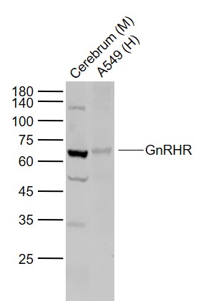 Lane 1: Mouse Cerebrum lysates; Lane 2: Jurkat cell lysates probed with GnRHR Polyclonal Antibody, Unconjugated (bs-1464R) at 1:1000 dilution and 4˚C overnight incubation. Followed by conjugated secondary antibody incubation at 1:20000 for 60 min at 37˚C.
