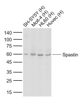 Lane 1: Human SH-SY5Y cell lysates; Lane 2: Human Molt-4 cell lysates; Lane 3: Human HL60 cell lysates; Lane 4: Human Huvec cell lysates probed with Spastin Polyclonal Antibody, Unconjugated (bs-1770R) at 1:1000 dilution and 4°C overnight incubation. Followed by conjugated secondary antibody incubation at 1:20000 for 60 min at 37˚C.
