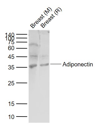 Lane 1: Mouse Breast tissue lysates; Lane 2: Rat Breast tissue lysates probed with Adiponectin Polyclonal Antibody, Unconjugated (bs-0471R) at 1:1000 dilution and 4°C overnight incubation. Followed by conjugated secondary antibody incubation at 1:20000 for 60 min at 37˚C.