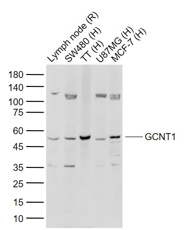 Lane 1: Rat Lymph node tissue lysates; Lane 2: Human SW480 cell lysates; Lane 3: Human TT cell lysates; Lane 4: Human U87MG cell lysates; Lane 5: Human MCF-7 cell lysates probed with GCNT1 Polyclonal Antibody, Unconjugated (bs-12334R) at 1:1000 dilution and 4°C overnight incubation. Followed by conjugated secondary antibody incubation at 1:20000 for 60 min at 37˚C.