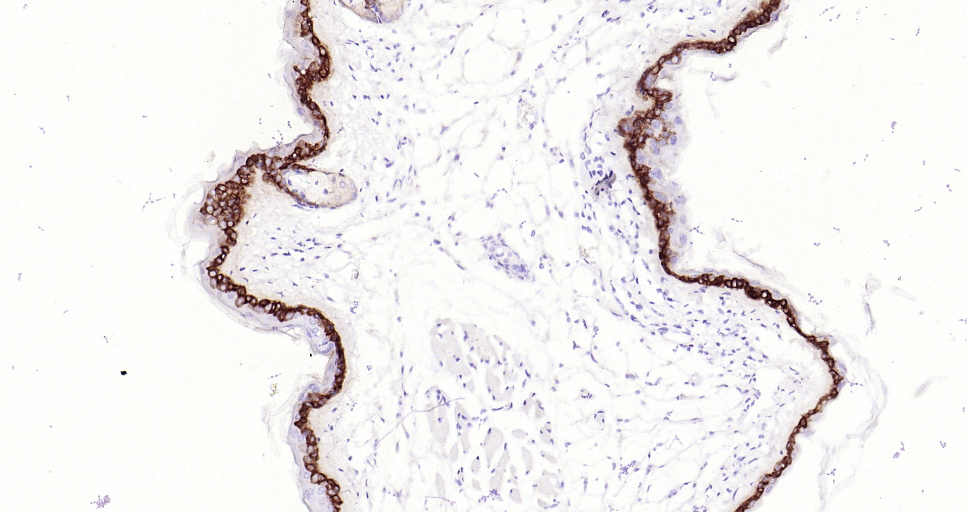Paraformaldehyde-fixed, paraffin embedded Mouse skin; Antigen retrieval by boiling in sodium citrate buffer (pH6.0) for 15min; Block endogenous peroxidase by 3% hydrogen peroxide for 20 minutes; Blocking buffer (normal goat serum) at 37°C for 30min; Antibody incubation with Collagen 17 (1C11) Monoclonal Antibody, Unconjugated (bsm-52041R) at 1:200 overnight at 4°C, DAB staining. Paraformaldehyde-fixed, paraffin embedded Mouse skin; Antigen retrieval by boiling in sodium citrate buffer (pH6.0) for 15min; Block endogenous peroxidase by 3% hydrogen peroxide for 20 minutes; Blocking buffer (normal goat serum) at 37°C for 30min; Antibody incubation with Collagen 17 (1C11) Monoclonal Antibody, Unconjugated (bsm-52041R) at 1:200 overnight at 4°C, DAB staining.