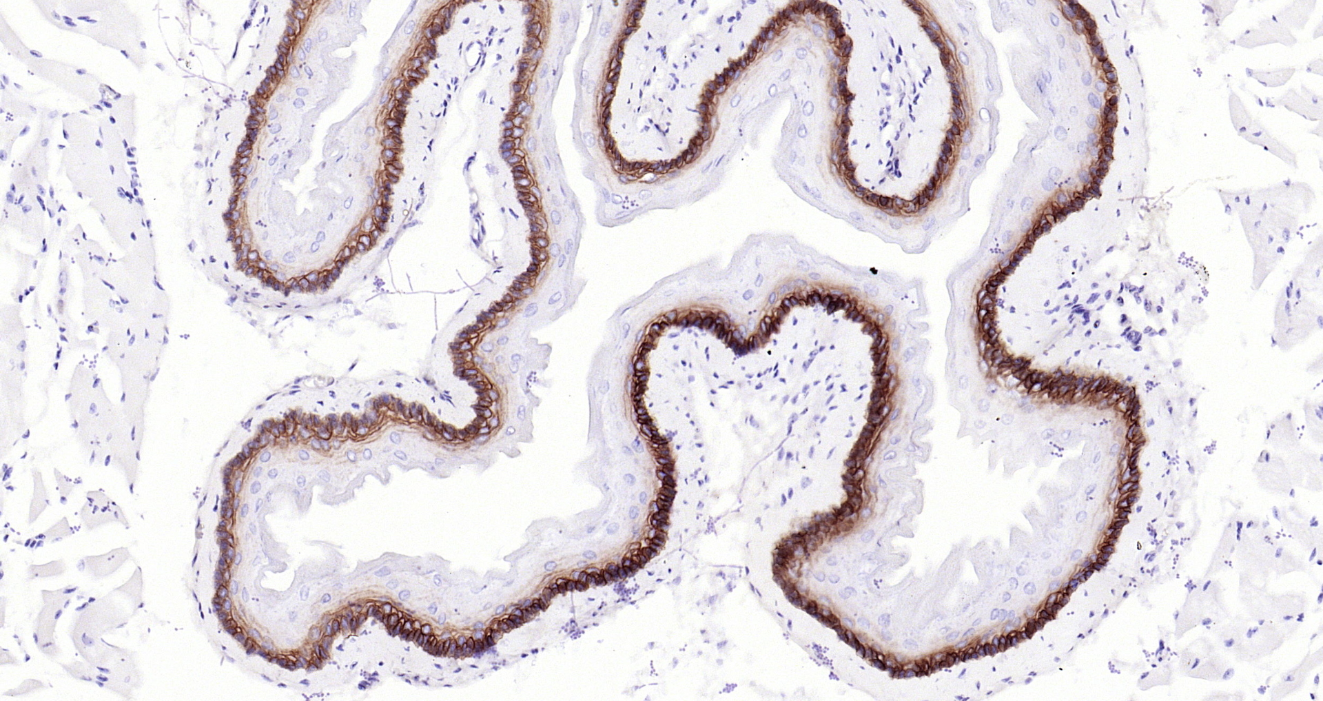 Paraformaldehyde-fixed, paraffin embedded Mouse esophagus; Antigen retrieval by boiling in sodium citrate buffer (pH6.0) for 15min; Block endogenous peroxidase by 3% hydrogen peroxide for 20 minutes; Blocking buffer (normal goat serum) at 37°C for 30min; Antibody incubation with Collagen 17 (1C11) Monoclonal Antibody, Unconjugated (bsm-52041R) at 1:200 overnight at 4°C, DAB staining. Paraformaldehyde-fixed, paraffin embedded Mouse esophagus; Antigen retrieval by boiling in sodium citrate buffer (pH6.0) for 15min; Block endogenous peroxidase by 3% hydrogen peroxide for 20 minutes; Blocking buffer (normal goat serum) at 37°C for 30min; Antibody incubation with Collagen 17 (1C11) Monoclonal Antibody, Unconjugated (bsm-52041R) at 1:200 overnight at 4°C, DAB staining.