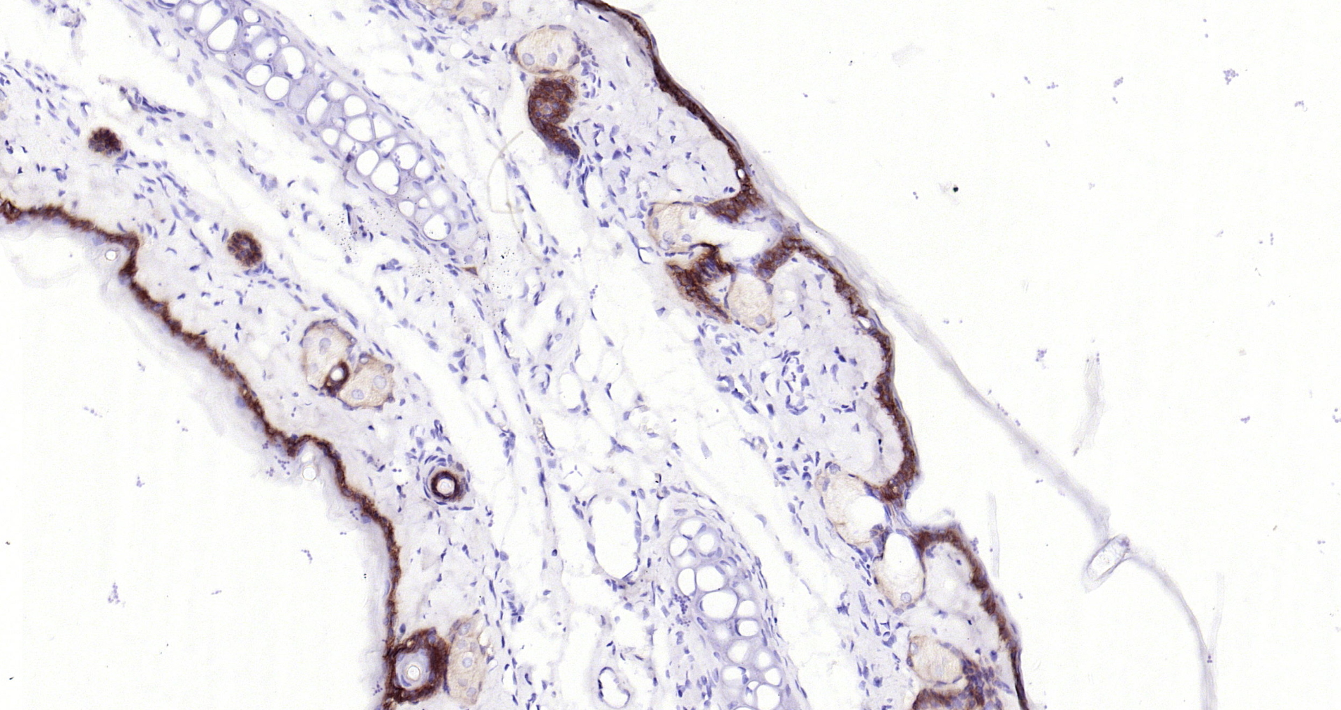 Paraformaldehyde-fixed, paraffin embedded Rat skin; Antigen retrieval by boiling in sodium citrate buffer (pH6.0) for 15min; Block endogenous peroxidase by 3% hydrogen peroxide for 20 minutes; Blocking buffer (normal goat serum) at 37°C for 30min; Antibody incubation with Collagen 17 (1C11) Monoclonal Antibody, Unconjugated (bsm-52041R) at 1:200 overnight at 4°C, DAB staining. Paraformaldehyde-fixed, paraffin embedded Rat skin; Antigen retrieval by boiling in sodium citrate buffer (pH6.0) for 15min; Block endogenous peroxidase by 3% hydrogen peroxide for 20 minutes; Blocking buffer (normal goat serum) at 37°C for 30min; Antibody incubation with Collagen 17 (1C11) Monoclonal Antibody, Unconjugated (bsm-52041R) at 1:200 overnight at 4°C, DAB staining.