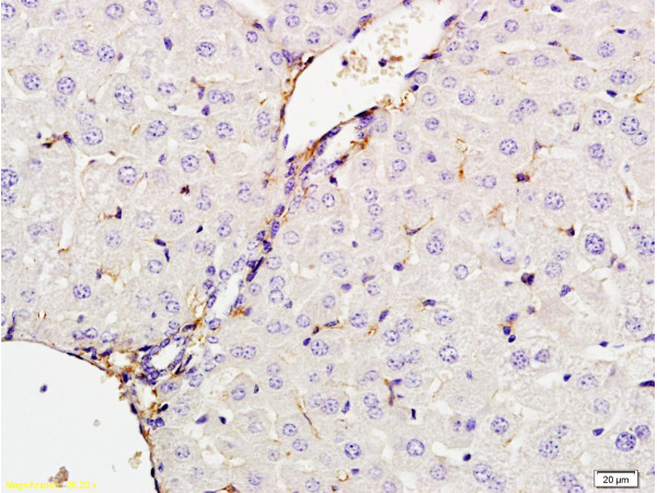 Formalin-fixed and paraffin embedded rat liver tissue labeled with Anti-CXCL13 Polyclonal Antibody, Unconjugated (bs-4509R) at 1:200 followed by conjugation to the secondary antibody and DAB staining