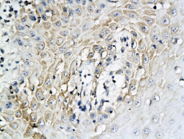 Formalin-fixed and paraffin embedded human oral mucosa labeled with Anti-IL-6 Polyclonal Antibody, Unconjugated (bs-4539R) followed by conjugation to the secondary antibody and DAB staining