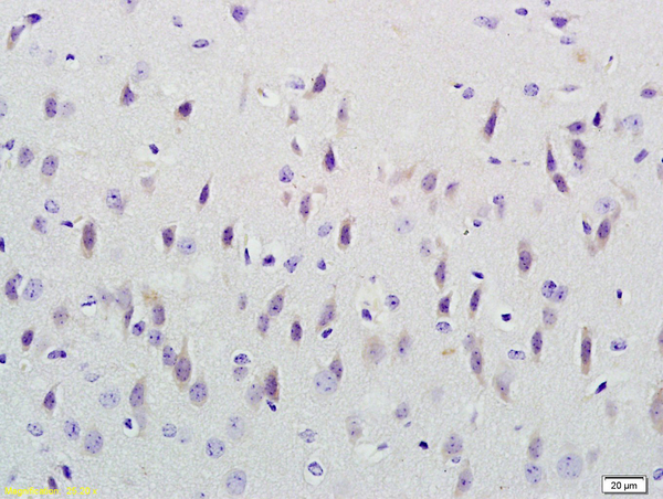 Formalin-fixed and paraffin embedded mouse brain labeled with Anti-CUEDC2/CUE domain containing 2 Polyclonal Antibody, Unconjugated (bs-4608R) at 1:4000 followed by conjugation to the secondary antibody and DAB staining