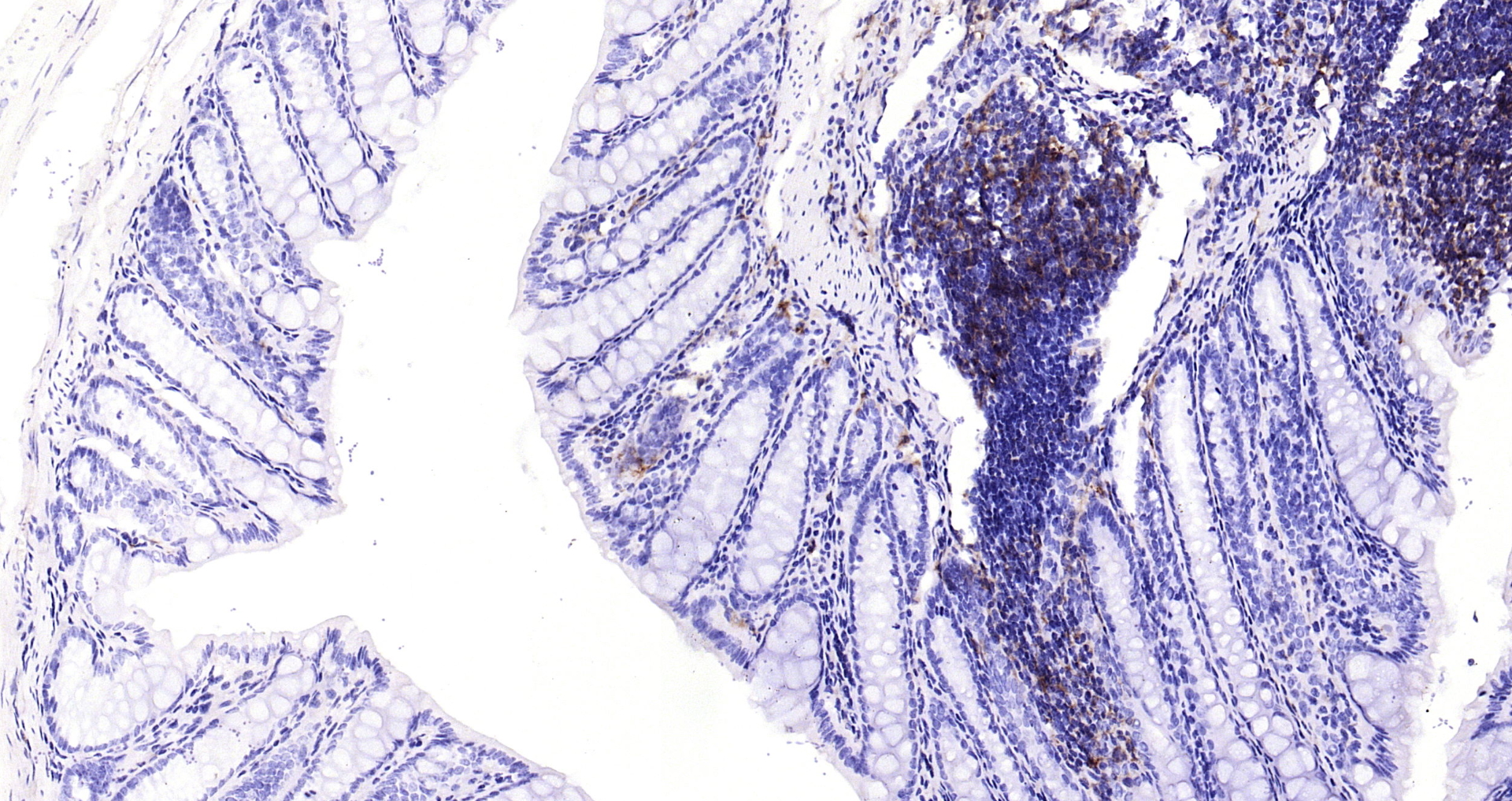 Paraformaldehyde-fixed, paraffin embedded Mouse colon; Antigen retrieval by boiling in sodium citrate buffer (pH6.0) for 15min; Block endogenous peroxidase by 3% hydrogen peroxide for 20 minutes; Blocking buffer (normal goat serum) at 37°C for 30min; Antibody incubation with HLA-DQA1 (8C1) Monoclonal Antibody, Unconjugated (bsm-54201R) at 1:200 overnight at 4°C, DAB staining.