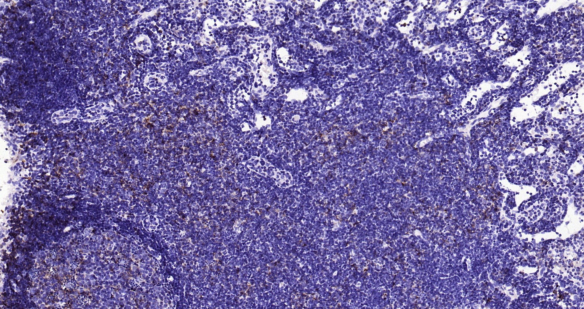 Paraformaldehyde-fixed, paraffin embedded Mouse lymph node; Antigen retrieval by boiling in sodium citrate buffer (pH6.0) for 15min; Block endogenous peroxidase by 3% hydrogen peroxide for 20 minutes; Blocking buffer (normal goat serum) at 37°C for 30min; Antibody incubation with HLA-DQA1 (8C1) Monoclonal Antibody, Unconjugated (bsm-54201R) at 1:200 overnight at 4°C, DAB staining.