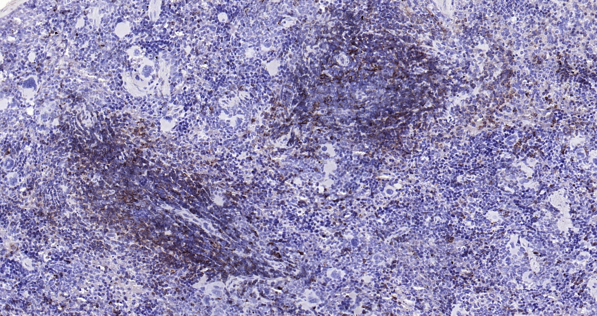 Paraformaldehyde-fixed, paraffin embedded Mouse spleen; Antigen retrieval by boiling in sodium citrate buffer (pH6.0) for 15min; Block endogenous peroxidase by 3% hydrogen peroxide for 20 minutes; Blocking buffer (normal goat serum) at 37°C for 30min; Antibody incubation with HLA-DQA1 (8C1) Monoclonal Antibody, Unconjugated (bsm-54201R) at 1:200 overnight at 4°C, DAB staining.