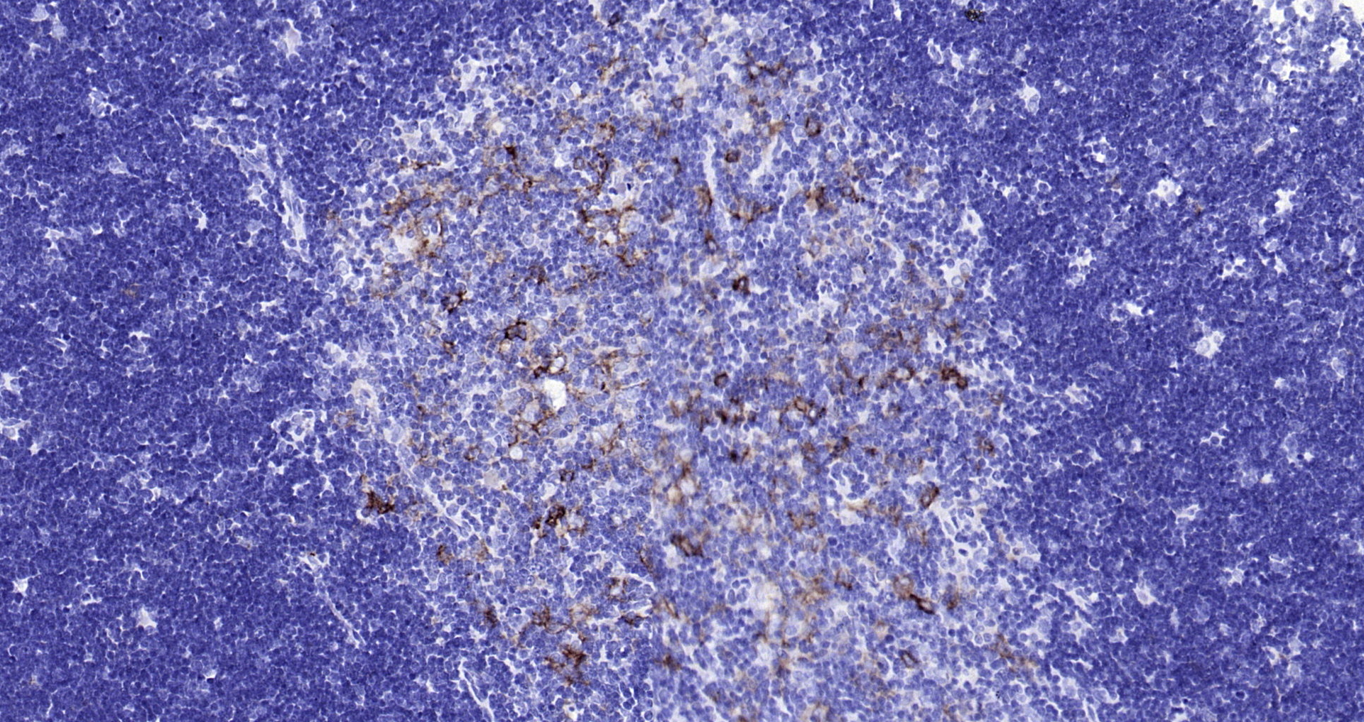 Paraformaldehyde-fixed, paraffin embedded Rat thymus; Antigen retrieval by boiling in sodium citrate buffer (pH6.0) for 15min; Block endogenous peroxidase by 3% hydrogen peroxide for 20 minutes; Blocking buffer (normal goat serum) at 37°C for 30min; Antibody incubation with HLA-DQA1 (8C1) Monoclonal Antibody, Unconjugated (bsm-54201R) at 1:200 overnight at 4°C, DAB staining.