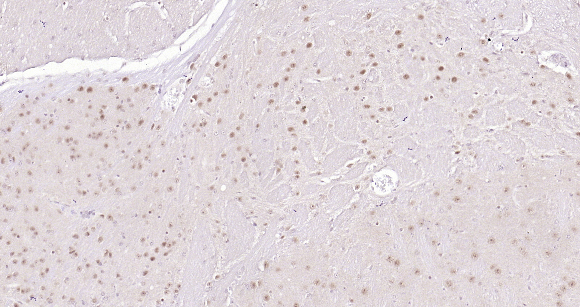 Paraformaldehyde-fixed, paraffin embedded Mouse brain; Antigen retrieval by boiling in sodium citrate buffer (pH6.0) for 15min; Block endogenous peroxidase by 3% hydrogen peroxide for 20 minutes; Blocking buffer (normal goat serum) at 37°C for 30min; Antibody incubation with CSNK2B (2C9) Monoclonal Antibody, Unconjugated (bsm-54217R) at 1:200 overnight at 4°C, DAB staining.