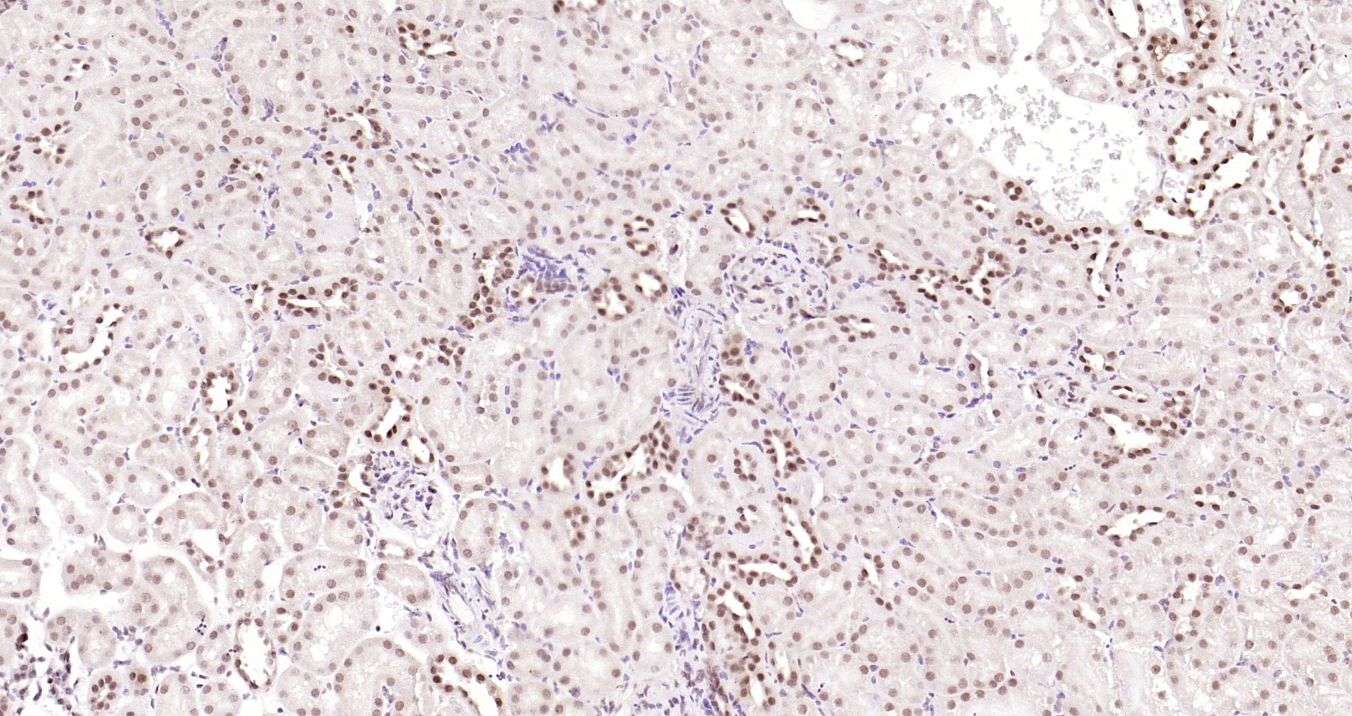 Paraformaldehyde-fixed, paraffin embedded Mouse kidney; Antigen retrieval by boiling in sodium citrate buffer (pH6.0) for 15min; Block endogenous peroxidase by 3% hydrogen peroxide for 20 minutes; Blocking buffer (normal goat serum) at 37°C for 30min; Antibody incubation with CSNK2B (2C9) Monoclonal Antibody, Unconjugated (bsm-54217R) at 1:200 overnight at 4°C, DAB staining.