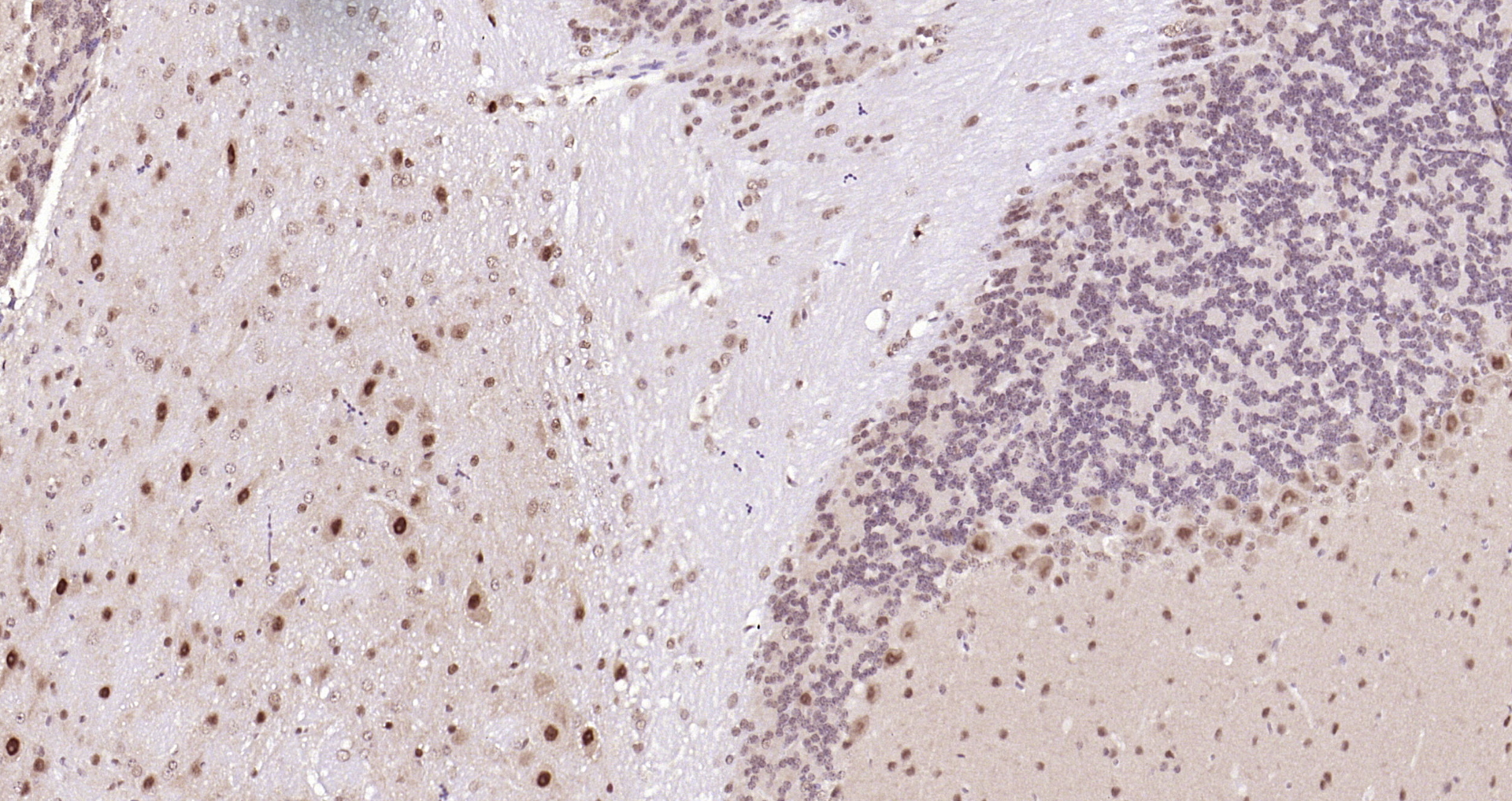 Paraformaldehyde-fixed, paraffin embedded Mouse cerebellum; Antigen retrieval by boiling in sodium citrate buffer (pH6.0) for 15min; Block endogenous peroxidase by 3% hydrogen peroxide for 20 minutes; Blocking buffer (normal goat serum) at 37°C for 30min; Antibody incubation with CSNK2B (2C9) Monoclonal Antibody, Unconjugated (bsm-54217R) at 1:200 overnight at 4°C, DAB staining.