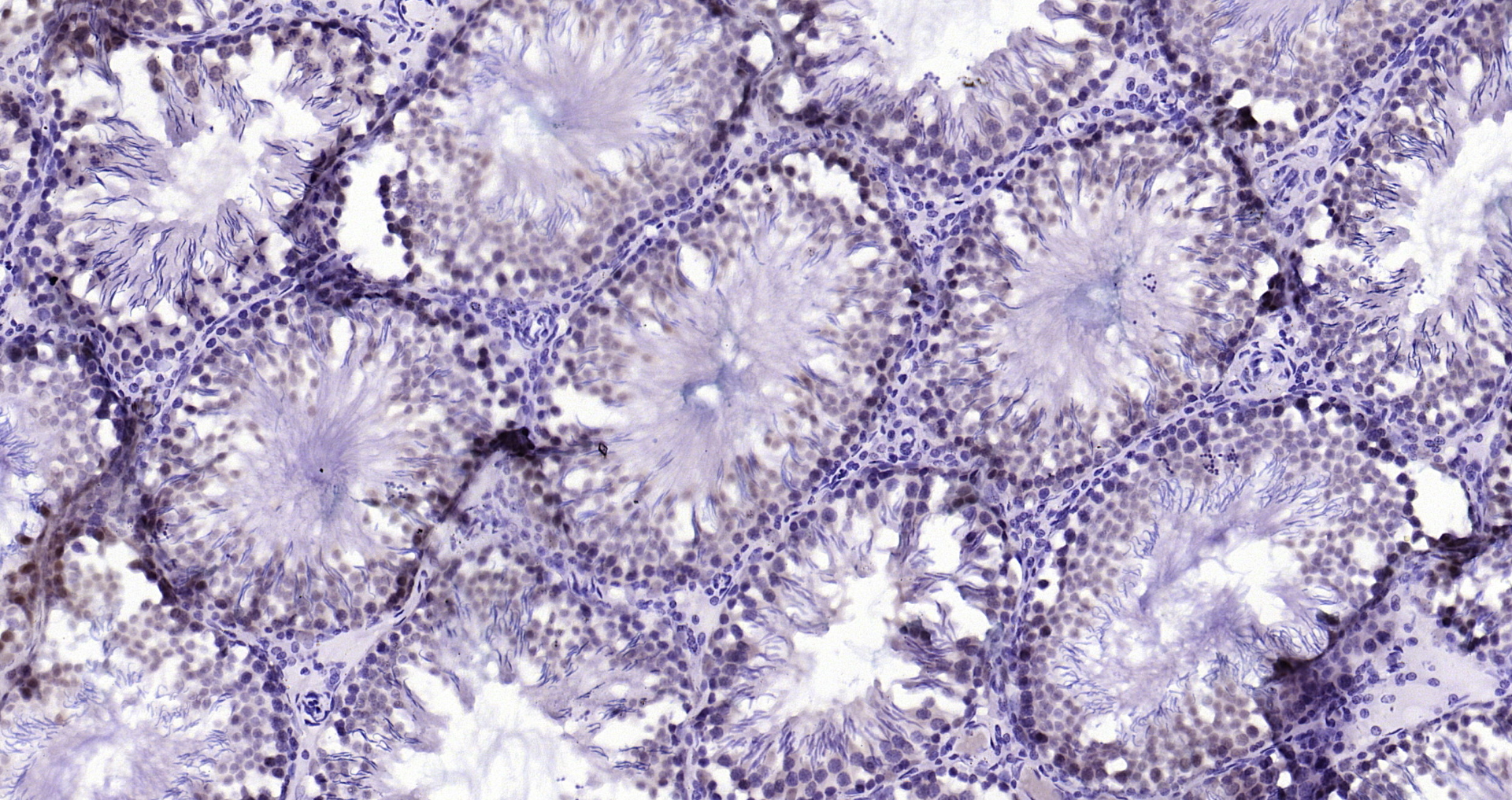 Paraformaldehyde-fixed, paraffin embedded Rat testis; Antigen retrieval by boiling in sodium citrate buffer (pH6.0) for 15min; Block endogenous peroxidase by 3% hydrogen peroxide for 20 minutes; Blocking buffer (normal goat serum) at 37°C for 30min; Antibody incubation with CSNK2B (2C9) Monoclonal Antibody, Unconjugated (bsm-54217R) at 1:200 overnight at 4°C, DAB staining.