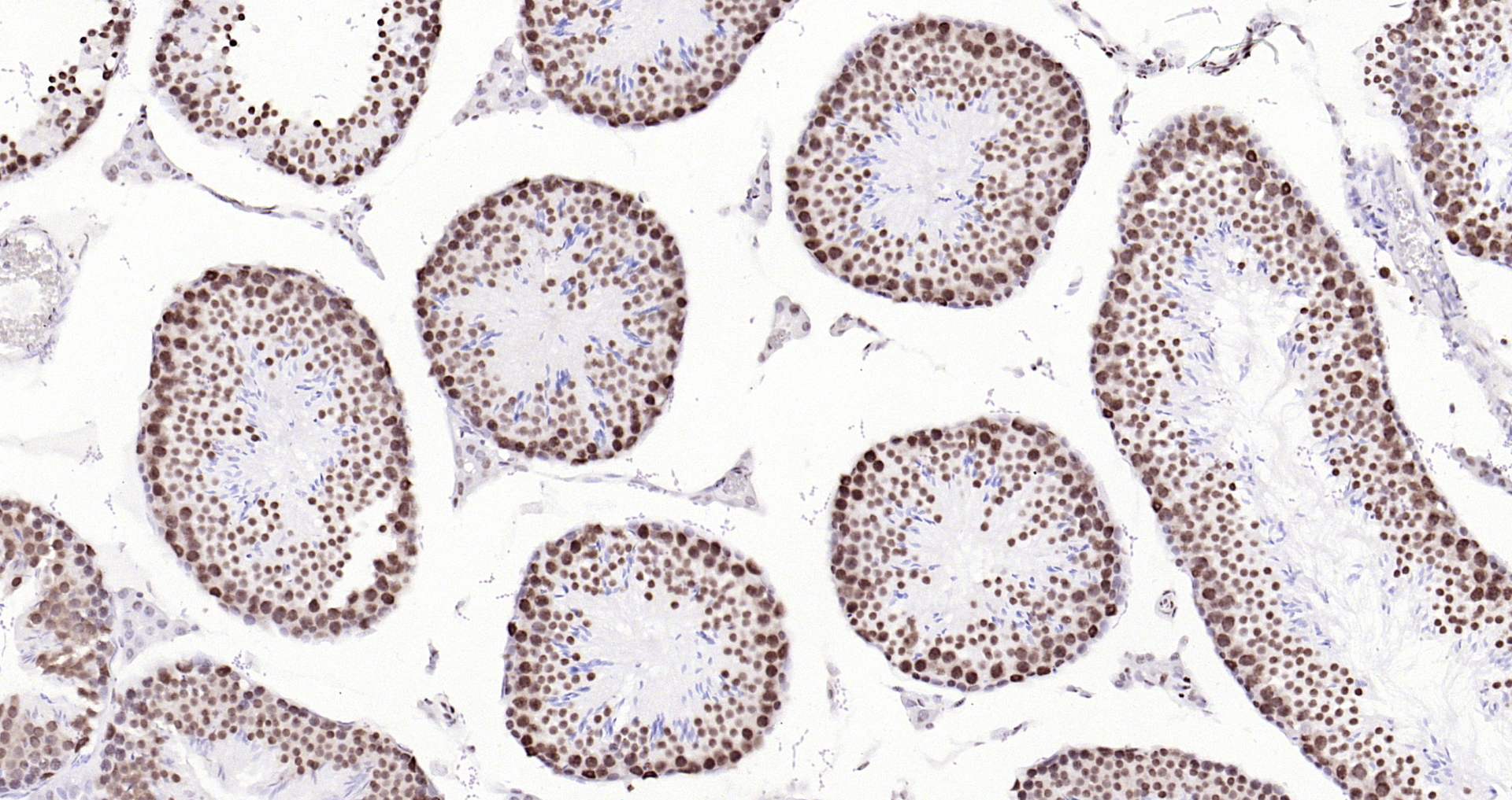 Paraformaldehyde-fixed, paraffin embedded Mouse testis; Antigen retrieval by boiling in sodium citrate buffer (pH6.0) for 15min; Block endogenous peroxidase by 3% hydrogen peroxide for 20 minutes; Blocking buffer (normal goat serum) at 37°C for 30min; Antibody incubation with BUB3 (24D1) Monoclonal Antibody, Unconjugated (bsm-54413R) at 1:200 overnight at 4°C, DAB staining.