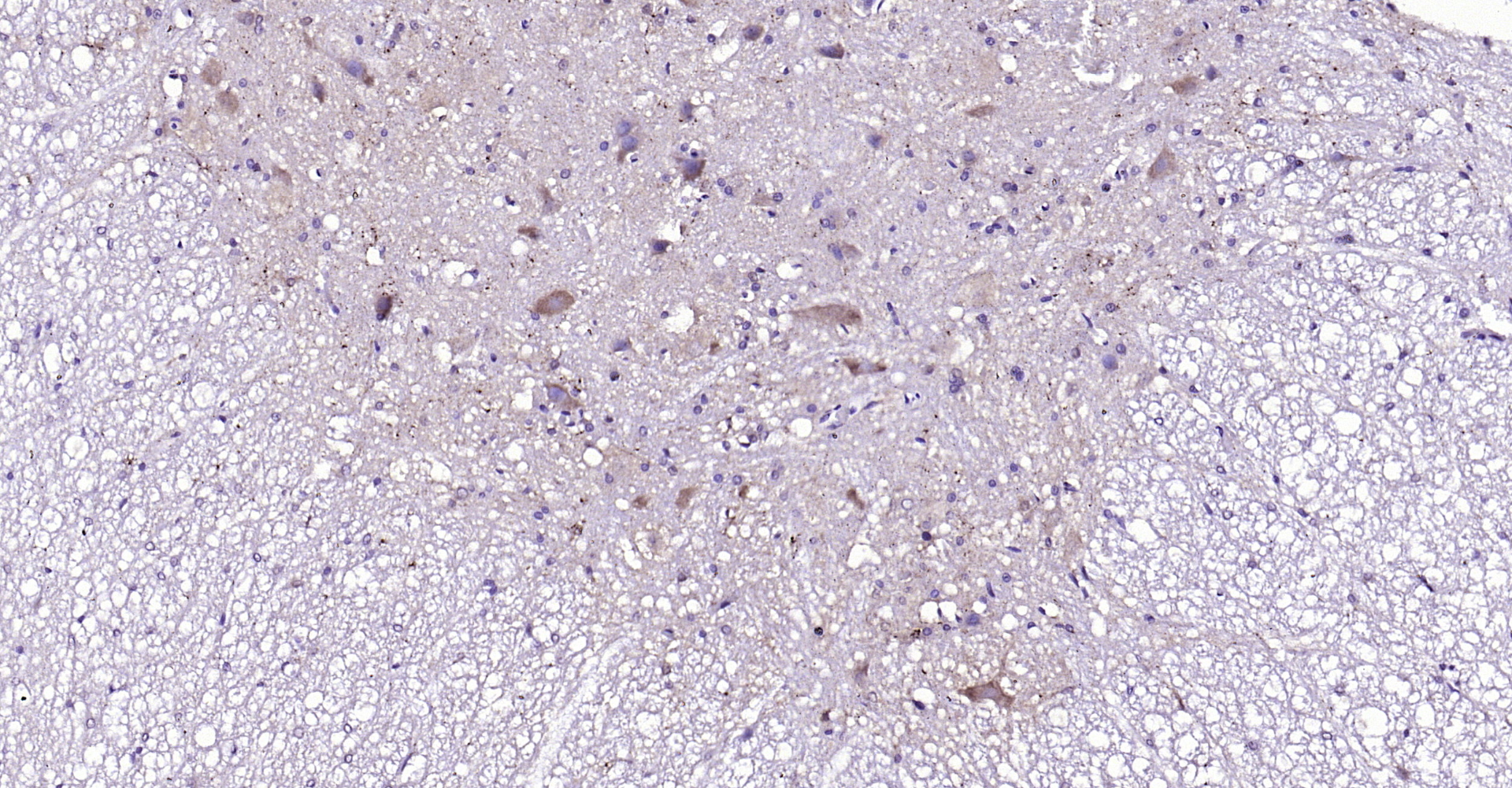 Paraformaldehyde-fixed, paraffin embedded Rat spinal cord; Antigen retrieval by boiling in sodium citrate buffer (pH6.0) for 15min; Block endogenous peroxidase by 3% hydrogen peroxide for 20 minutes; Blocking buffer (normal goat serum) at 37°C for 30min; Antibody incubation with NKB Polyclonal Antibody, Unconjugated (bs-0070R) at 1:200 overnight at 4°C, DAB staining.