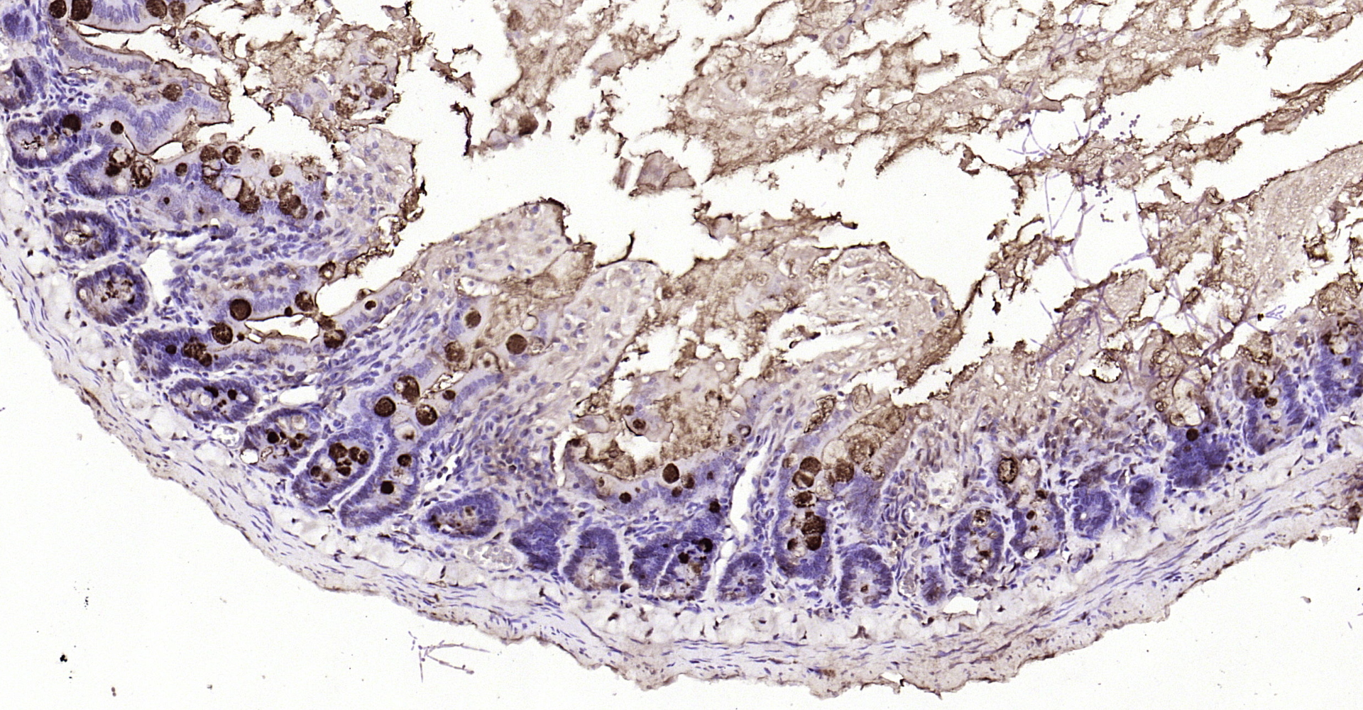 Paraformaldehyde-fixed, paraffin embedded Rat intestine; Antigen retrieval by boiling in sodium citrate buffer (pH6.0) for 15min; Block endogenous peroxidase by 3% hydrogen peroxide for 20 minutes; Blocking buffer (normal goat serum) at 37°C for 30min; Antibody incubation with NKB Polyclonal Antibody, Unconjugated (bs-0070R) at 1:200 overnight at 4°C, DAB staining.